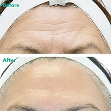 Load image into Gallery viewer, Rejuran® Advanced Anti-Aging Retinol + c-PDRN® Serum for Face and Neck – Triple Action with c-PDRN®, Retinol, and Peptides
