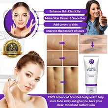 Load image into Gallery viewer, CSCS Most Effective Scar Remover Cream with Hydrolyzed Collagen &amp; Vitamin E - Heals Old &amp; New Scars from Cuts, Acne, Stretch Marks, Burns &amp; Post Surgeries Scars - Fast Results, for All Skin Types 2 oz
