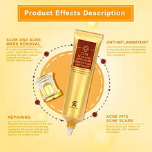 Load image into Gallery viewer, Scar Removal Cream For Old Scars- Stretch Mark Removal Gel for Men &amp; Women- Stretch Marks Relief and Burns Repair,Face Skin Repair Gel
