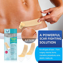Load image into Gallery viewer, Scar Removal Patch, Scar Removal Strips Fast &amp; Effective on Keloid, Professional Removal Sheets for Scars Caused by C-Section, Surgery, Burn, Acne, 2 Reusable Scar Sheets, 1.6"×6.5"
