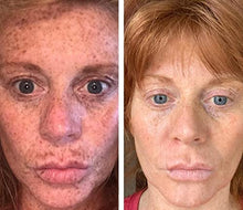 Load image into Gallery viewer, Potent Dark Spot Corrector Remover For Face &amp; Retinol Cream Provides the Most Effective Combination For Fading &amp; Removing Dark Spots
