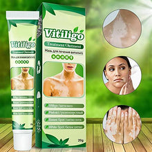 Load image into Gallery viewer, ZCXZ 6PCS White Tag Treatment Moisturizing Cream, Vitiligo Cream for White Spots On Skin, Improve Skin Pigmentation, Reduces Leukoplakia
