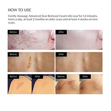 Load image into Gallery viewer, Scar Removal Cream - Advanced Treatment for Face &amp; Body, Old &amp; New Scars from Cuts, Stretch Marks, C-Sections &amp; Surgeries - With Natural Herbal Extracts Formula
