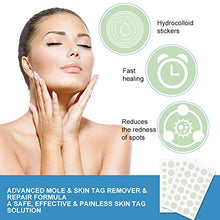 Load image into Gallery viewer, Skin Tag Removal Patches,Skin Tag Remover Patches,Skin Tag Removal,Skin Tag Acne Remover Patches,Mole Remover Patches,Cover and Conceal Skin Tags
