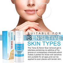 Load image into Gallery viewer, Silicone Scar Gel-Kinbeau Scar Remover Gel for Face, Body, C-Section Stretch Marks, Surgical, Burn, Acne, Old &amp; New Scars,30g/1 OZ (white blue)
