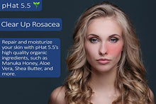 Load image into Gallery viewer, Rosacea Red Skin and Acne Cream - with Manuka Honey, Aloe Vera &amp; Coconut Oil - Redness, Inflammation, Acne and Rosacea Relief - Paraben &amp; Sulfate Free (2 oz)
