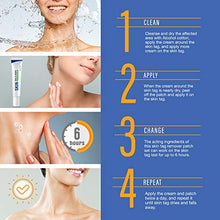 Load image into Gallery viewer, Pureskin Safe &amp; Effective Formula Skin Tag Remover Patches Set, Skin Tag Removal Patches Set with Natural Ingredients for Your Skin Tag
