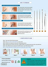 Load image into Gallery viewer, 5PCS Blackhead Remover Comedone Extractor, Curved Blackhead Tweezers Kit, Professional Stainless Pimple Acne Blemish Removal Tools Kit
