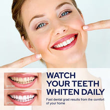 Load image into Gallery viewer, VieBeauti Teeth Whitening Kit - 5X LED Light Tooth Whitener with 35% Carbamide Peroxide, Mouth Trays, Remineralizing Gel and Tray Case - Built-In 10 Minute Timer Restores Your Gleaming White Smile
