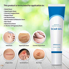 Load image into Gallery viewer, Aroamas Advanced Scar Gel Medical-Grade Silicone for Face, Body, Stretch Marks, C-Sections, Surgical, Burn, Acne, Old &amp; New Scars, Clinically Proven, 30g

