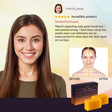 Load image into Gallery viewer, Valitic Kojic Acid Dark Spot Remover Soap Bars with Vitamin C, Retinol, Collagen, Turmeric - Original Japanese Complex Infused with Hyaluronic Acid, Vitamin E, Shea Butter, Castile Olive Oil (4-Pack)
