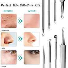 Load image into Gallery viewer, Blackhead Remover Face Mask,Black Mask,3-in-1 Purifying Charcoal Peel off Mask with Acne &amp; Blackhead Extractor Kit and Silicone Brush,Deep Cleansing Facial Mask for All Skin Types Face &amp; Nose
