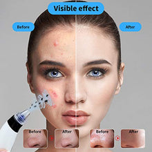 Load image into Gallery viewer, Blackhead Remover,Zdatt Blackhead Vacume Remover -Comedo Pore Extracotr Beauty Device with 5 Probes for Blackhead Remover Vacume Suction Cleanser
