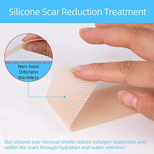Load image into Gallery viewer, Silicone Scar Removal Sheets 5 Month Supply,Reduce C-Section Stretch Mark Acne Burn Keloid Surgery Scars,Soft Adhesive Fabric Strips, 5.9"x1.38", 5 Reusable Sheets
