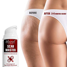 Load image into Gallery viewer, Ebanel Advanced Silicone Scar Gel, Scar Removal Cream for Old &amp; New Scars of Acne, Surgical, C-Section, Injuries, Burn, Cuts, Insect Bites, Stretch Marks with Vitamin E, Emu Oil, Onion Extract
