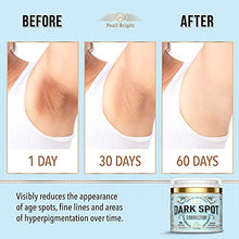 Load image into Gallery viewer, Dark Spot Remover for Face, Body and Sensitive areas - Natural Skincare for Underarms, Elbows &amp; Privates - Made in USA - Dark Spot Corrector with Licorice, Mulberry Extract Arbutin, 1.7OZ
