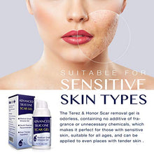 Load image into Gallery viewer, Scar Remover Gel for Scars from C-Section, Stretch Marks, Acne, Surgery, Effective for both Old and New Scars
