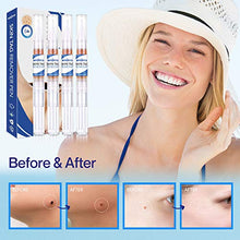 Load image into Gallery viewer, Reejoys Skin Tag &amp; Mole Removal - Safe &amp; Effective Formula for Skin Tag Remover (4 Packs)
