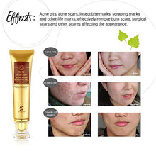 Load image into Gallery viewer, Scar Removal Cream For Old Scars- Stretch Mark Removal Gel for Men &amp; Women- Stretch Marks Relief and Burns Repair,Face Skin Repair Gel
