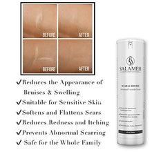 Load image into Gallery viewer, Doctor Salameh Scar and Bruise Cream Reduces The Appearance of Scars and Skin Discoloration with Arnica Oil and Vitamins K and E (1 oz)
