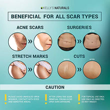 Load image into Gallery viewer, Scar Removal Cream - Effective Stretch Mark Removal - Natural Skin Repair - Acne Scar Remover Cream - Made in USA - Advanced Treatment for Old Scars &amp; Acne Scars - Clinically Proven Formula - 2 OZ
