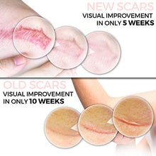 Load image into Gallery viewer, Scarbandit Medical Grade Silicone Scar Gel - Advanced Reducer for C-Section and Stretch Marks, Surgical, Acne Scars, Burn Wound - No Odor, Clear Spot Remover for the Face and Body - 25g, 0.88oz.
