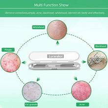 Load image into Gallery viewer, 5PCS Blackhead Remover Comedone Extractor, Curved Blackhead Tweezers Kit, Professional Stainless Pimple Acne Blemish Removal Tools Kit

