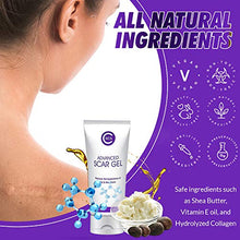 Load image into Gallery viewer, CSCS Most Effective Scar Remover Cream with Hydrolyzed Collagen &amp; Vitamin E - Heals Old &amp; New Scars from Cuts, Acne, Stretch Marks, Burns &amp; Post Surgeries Scars - Fast Results, for All Skin Types 2 oz
