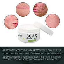 Load image into Gallery viewer, Scar Removal Cream For Old Scars -Stretch Mark Removal Cream for Men and Women Stretch Marks Relief and Burns Repair,Face Skin Repair Cream
