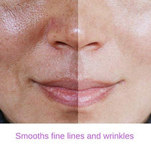 Load image into Gallery viewer, RETINOL 2.5% Serum, High Strength - Professional Anti- Aging Formula With Hyaluronic Acid and Vitamin E by Essence of Arcadia, Minimize Wrinkles, Fade Dark Spots
