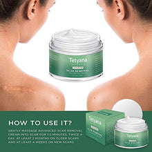 Load image into Gallery viewer, Scar Removal Cream Advanced Treatment for Old &amp; New Scars from Cuts Stretch Marks, C-Sections &amp; Surgeries With Natural Herbal Extracts Formula
