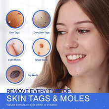Load image into Gallery viewer, Reejoys Skin Tag &amp; Mole Removal - Safe &amp; Effective Formula for Skin Tag Remover (4 Packs)
