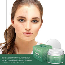 Load image into Gallery viewer, Scar Removal Cream Advanced Treatment for Old &amp; New Scars from Cuts Stretch Marks, C-Sections &amp; Surgeries With Natural Herbal Extracts Formula
