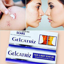 Load image into Gallery viewer, Gelcatriz Scar Treatment Gel | Scar Removal Gel for Diminishing the Visible Appearance of Acne Scars, Surgery Scars, Stretch Marks, Cuts &amp; Scrapes, and more; 1 Ounce Tube
