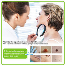Load image into Gallery viewer, 2 in 1 Skin Tag Remover - Auto Skin Tag Remover Pen Removal Kit Products Tool with 40 Micro and Regular Skin Tag Bands, User-Friendly, Safe and Painless Remove Small to Large (2mm-8mm) Sized Skin Tag
