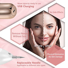 Load image into Gallery viewer, Skin Tag Remover, Skin Tag Removal Kit Tools with Home Usage USB Charging/30 Replaceable Device to Remove Skin Tags
