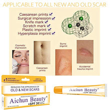 Load image into Gallery viewer, Scar Removal Cream For New &amp; Old Scars Stretch Mark Removal Surgery,Burn Marks Relief. advanced scar gel Acne Scars,
