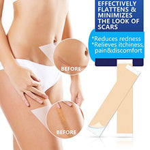 Load image into Gallery viewer, Scar Removal Patch, Scar Removal Strips Fast &amp; Effective on Keloid, Professional Removal Sheets for Scars Caused by C-Section, Surgery, Burn, Acne, 2 Reusable Scar Sheets, 1.6"×6.5"

