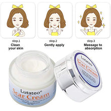 Load image into Gallery viewer, Scar Cream, Stretch Mark Cream, Acne Scar Removal Cream, Acne Spots Treatment, Burns Repair, Face Skin Repair Cream(50g)

