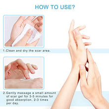 Load image into Gallery viewer, Silicone Scar Gel-Kinbeau Scar Remover Gel for Face, Body, C-Section Stretch Marks, Surgical, Burn, Acne, Old &amp; New Scars,30g/1 OZ (white blue)
