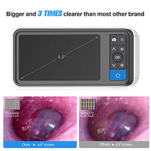 Load image into Gallery viewer, Digital Otoscope with 4.5 Inches Screen, Anykit 3.9mm Ear Camera with 6 LED Lights, 32GB Card, Ear Wax Removal Tool, Specula and 2500 mAh Rechargeable Battery, Supports Photo Snap and Video Recording
