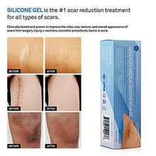 Load image into Gallery viewer, Aroamas Advanced Scar Gel Medical-Grade Silicone for Face, Body, Stretch Marks, C-Sections, Surgical, Burn, Acne, Old &amp; New Scars, Clinically Proven, 30g
