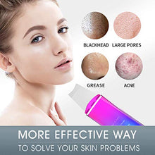 Load image into Gallery viewer, Skin Scrubber Face Spatula, JOYJULY Facial Cleansing Scraper Peel Pores Cleanser，Blackhead Removal Acne Extractor Skin Exfoliation Colorful
