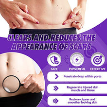 Load image into Gallery viewer, CSCS Most Effective Scar Remover Cream with Hydrolyzed Collagen &amp; Vitamin E - Heals Old &amp; New Scars from Cuts, Acne, Stretch Marks, Burns &amp; Post Surgeries Scars - Fast Results, for All Skin Types 2 oz
