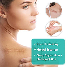 Load image into Gallery viewer, Scar Removal Cream, Scar Cream For Old Scars - Stretch Mark Removal Cream for Men &amp; Women - Stretch Marks Relief and Burns Repair, Face Skin Repair Cream
