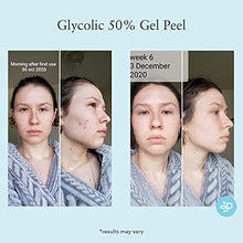 Load image into Gallery viewer, Glycolic Acid 50% Gel Peel - Enhanced with Retinol &amp; Green Tea Extract (Professional Skin Peel)1 ounce
