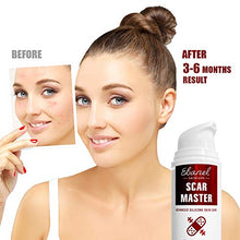 Load image into Gallery viewer, Ebanel Advanced Silicone Scar Gel, Scar Removal Cream for Old &amp; New Scars of Acne, Surgical, C-Section, Injuries, Burn, Cuts, Insect Bites, Stretch Marks with Vitamin E, Emu Oil, Onion Extract
