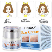 Load image into Gallery viewer, Scar Cream, Stretch Mark Cream, Acne Scar Removal Cream, Acne Spots Treatment, Burns Repair, Face Skin Repair Cream(50g)
