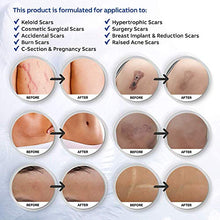 Load image into Gallery viewer, Puriderma Medical Silicone Scar Removal Sheets [Set of 5] - Fast &amp; Effective on Keloid, Surgery, Burn, Acne, C-Section Scars
