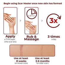 Load image into Gallery viewer, Ebanel Advanced Silicone Scar Gel, Scar Removal Cream for Old &amp; New Scars of Acne, Surgical, C-Section, Injuries, Burn, Cuts, Insect Bites, Stretch Marks with Vitamin E, Emu Oil, Onion Extract
